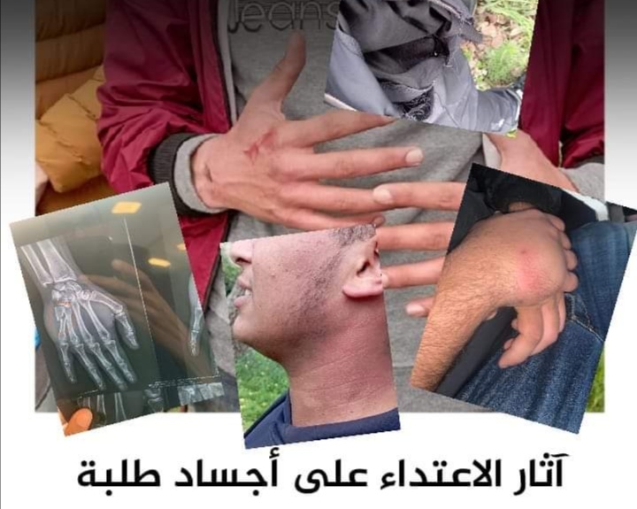 استنكار طلابي لمنع نشاط ضد التطبيع بجامعة القنيطرة وتنديد بالتدخل الأمني لتفريق المشاركين