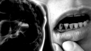 حالة استنفار بعد ظهور عشرات الحالات “غير المبررة والغامضة” من التهاب الكبد لدى أطفال